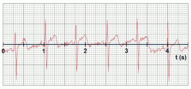 Click to Enlarge

Name: ecg1.gif
Size: 45 KB