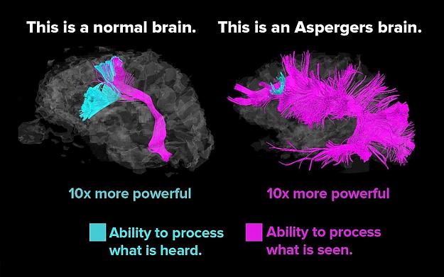 Click to Enlarge

Name: Asperger_vs_normal_brain.jpg
Size: 171 KB