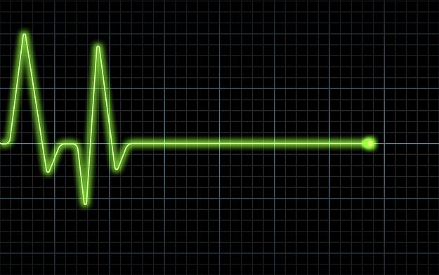 Click to Enlarge

Name: flatline-delirium-tremens.jpg
Size: 260 KB
