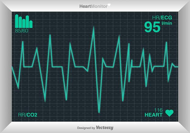Click to Enlarge

Name: cardiogramm.jpg
Size: 108 KB