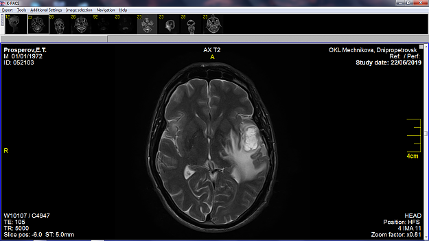 Click to Enlarge

Name: MRI22-06-19.png
Size: 389 KB