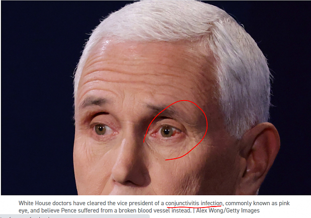 Click to Enlarge

Name: pence red eye.PNG
Size: 1.4 MB