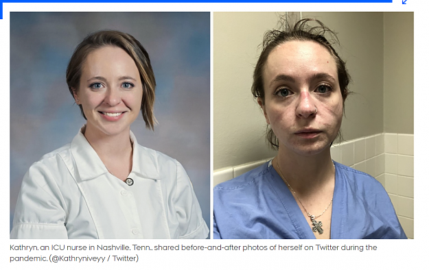 Click to Enlarge

Name: covid nurse before and after pic.PNG
Size: 1.3 MB
