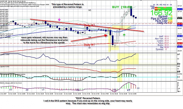 Click to Enlarge

Name: uj 006 ekg pattern.jpg
Size: 334 KB