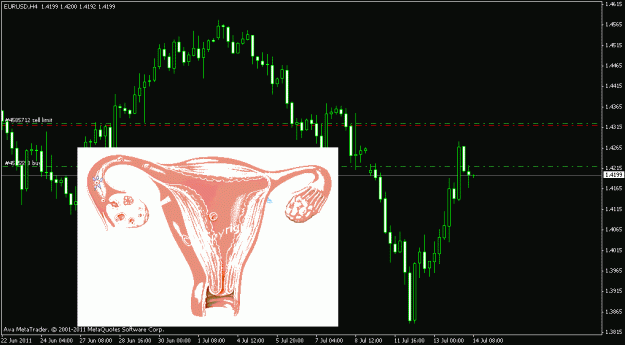 Click to Enlarge

Name: euro.gif
Size: 22 KB
